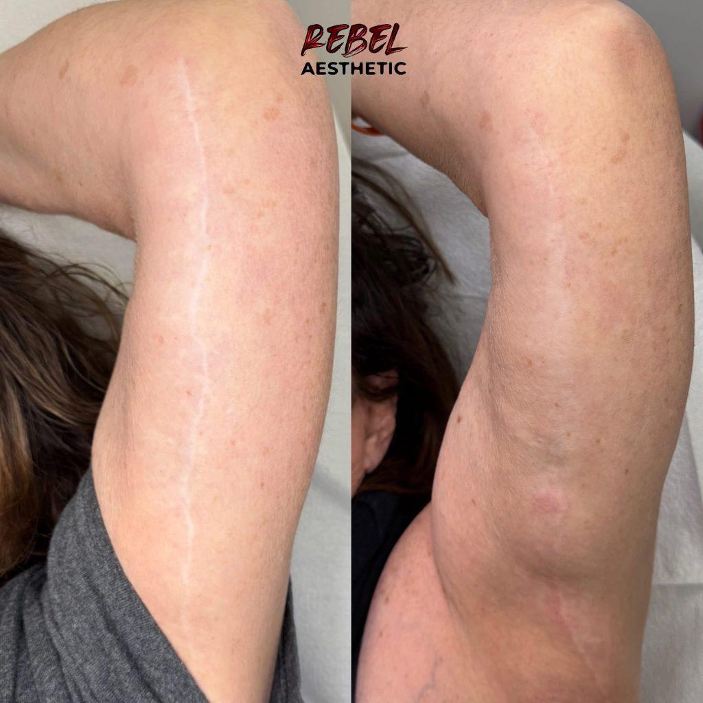 Permanent makeup result at Rebel Aesthetics in New Jersey.