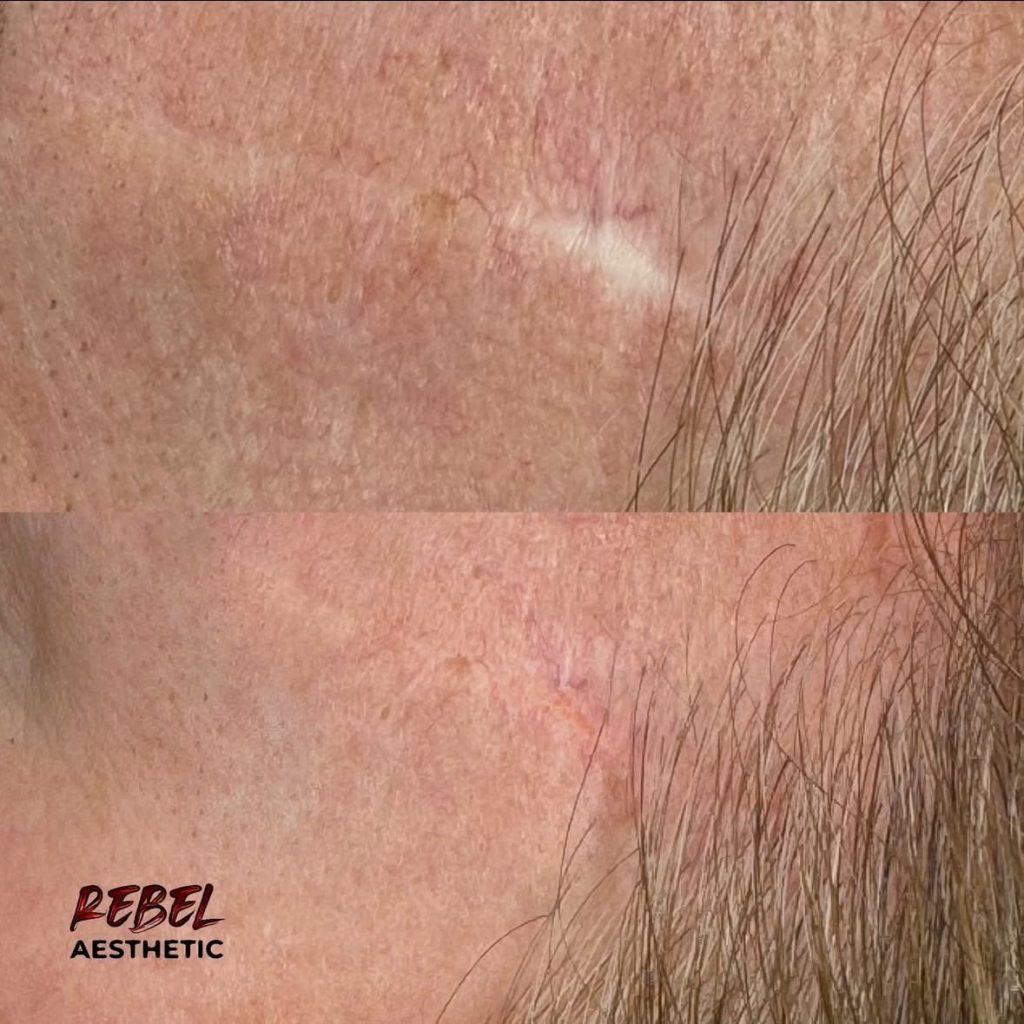 Permanent makeup result at Rebel Aesthetics in New Jersey.