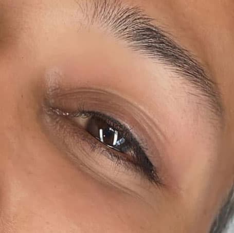Lash Enhancement