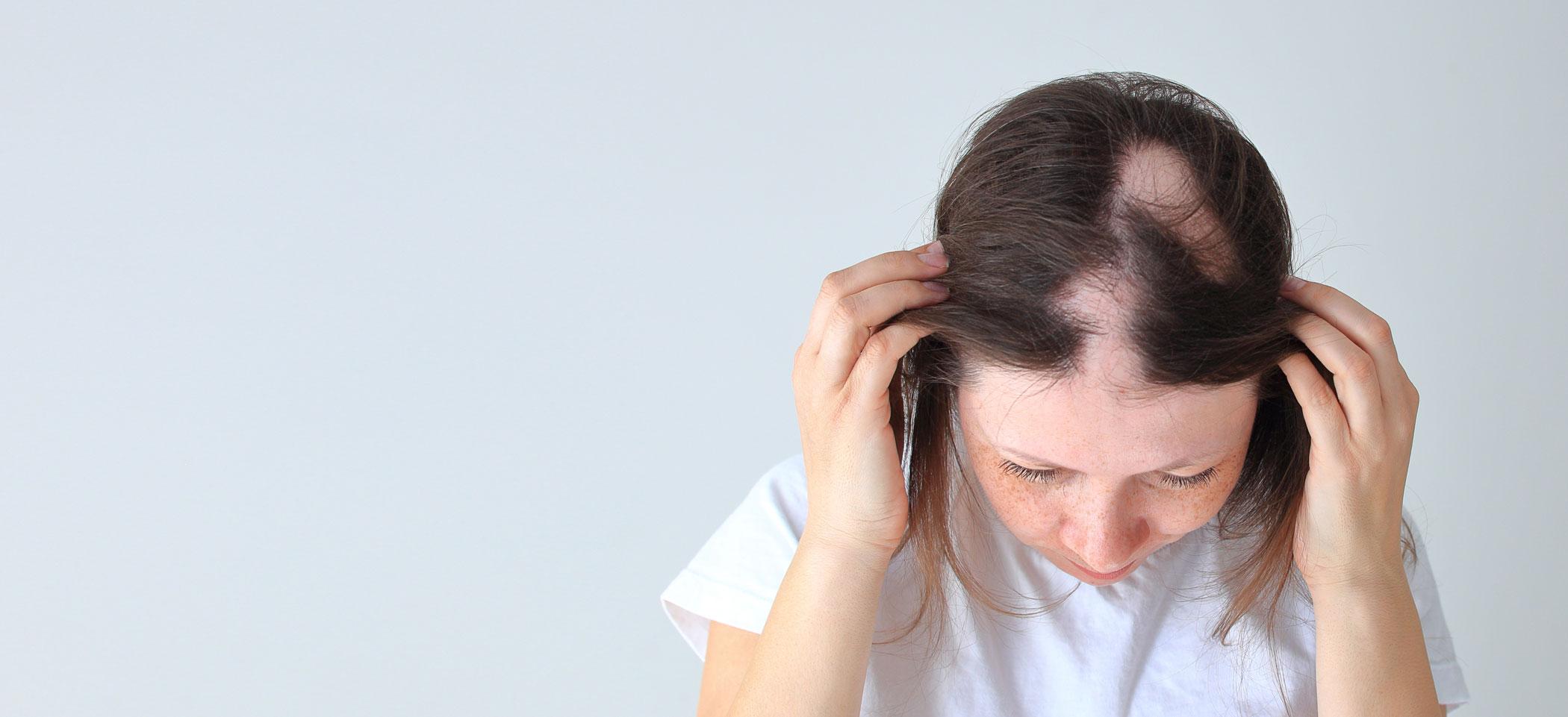 Woman parting her hair to look at an area of thinning