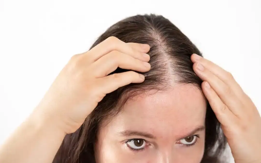 5 things every woman should know about SMP for hair density