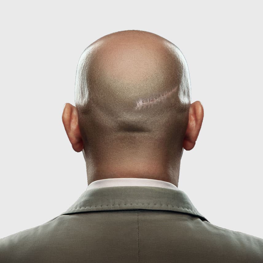 5 things I wish every plug scar client knew before their first SMP session