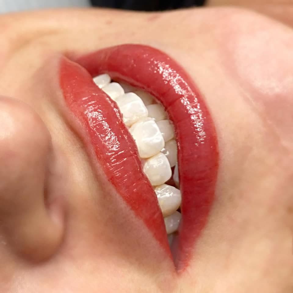 Lips