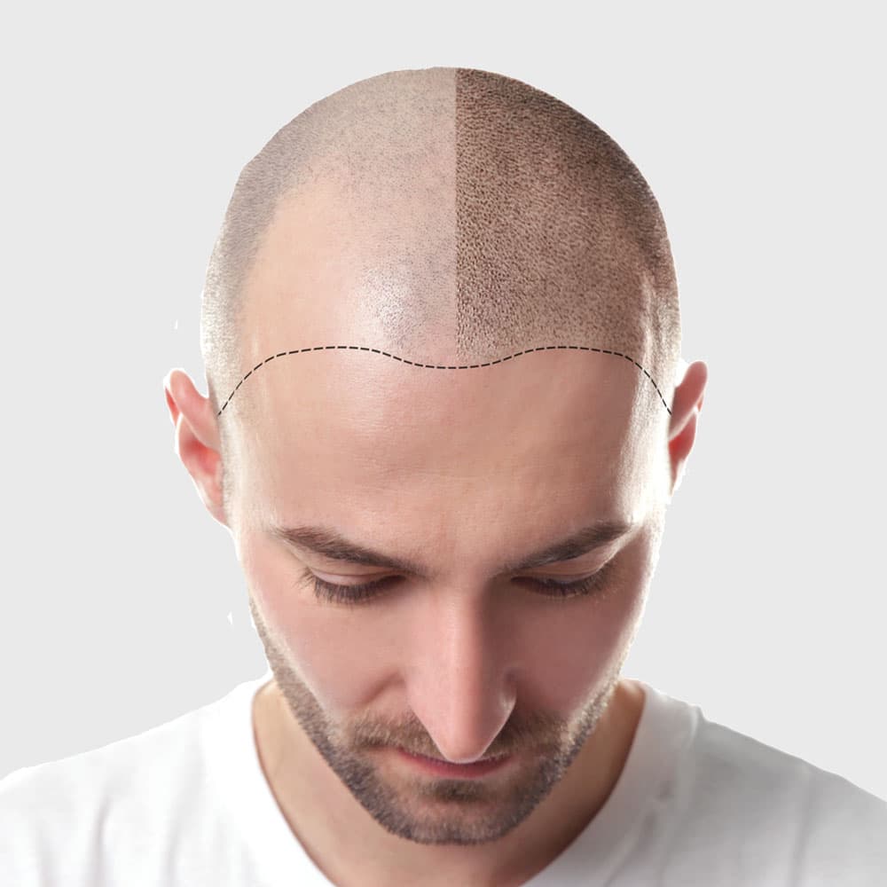 SMP for Men example 1