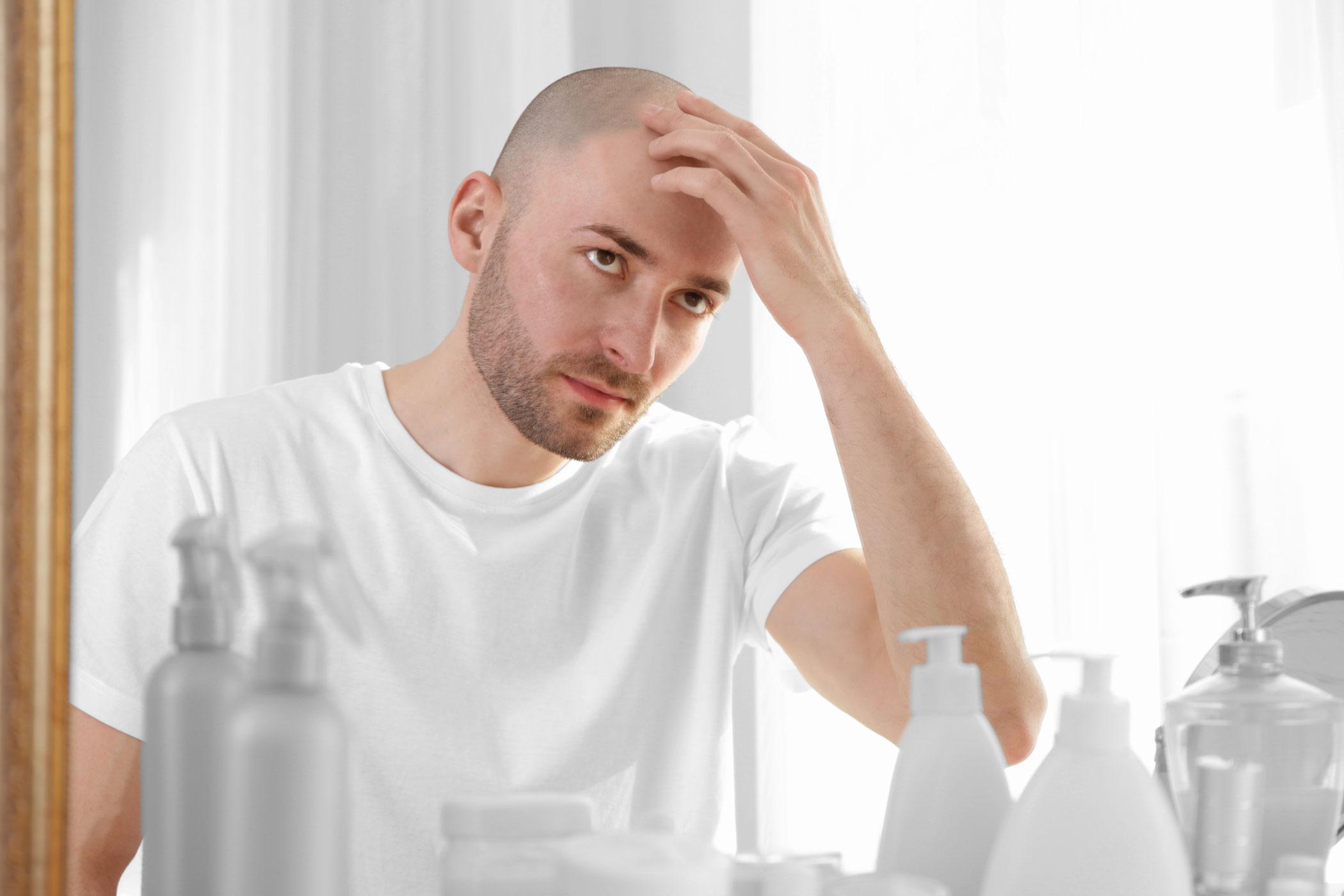 Man touching his shaved head