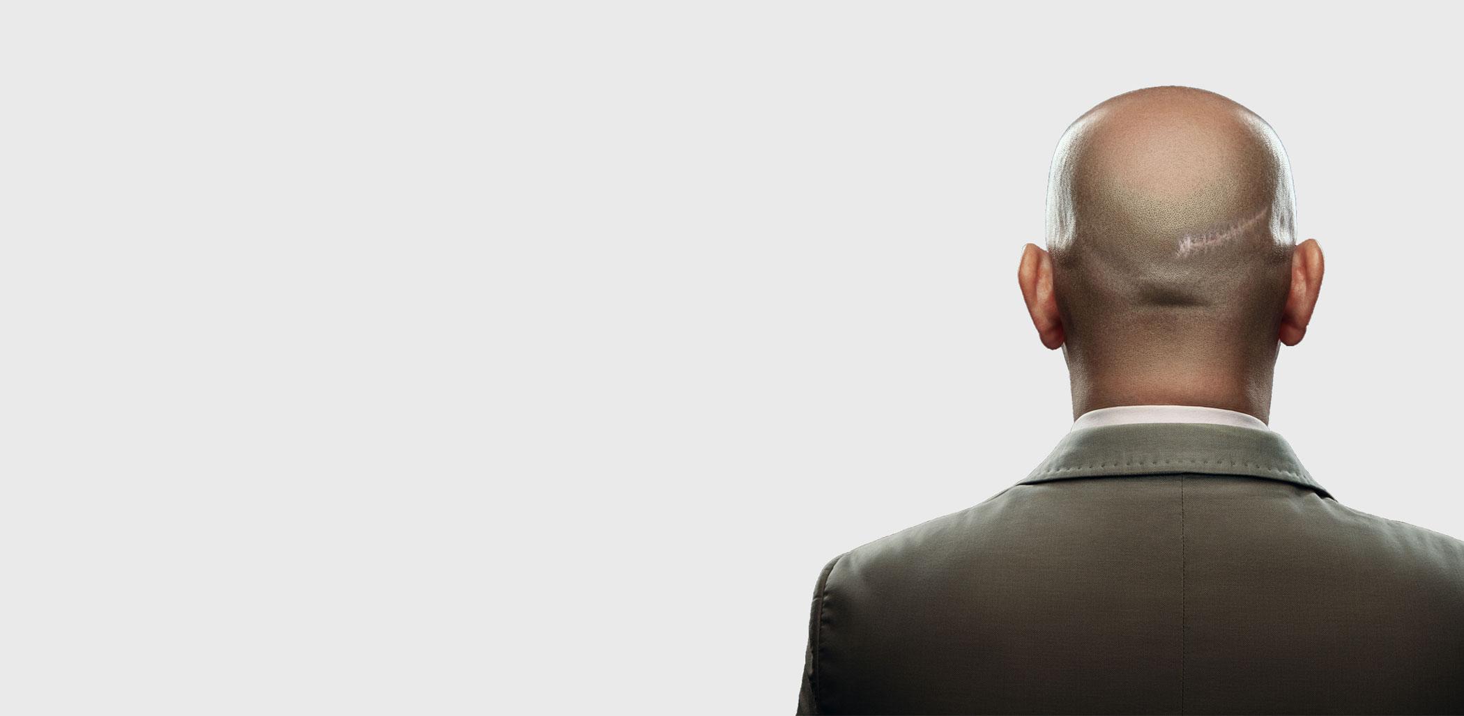 Man with a closely shaved head seen from behind